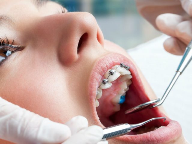 Dental Procedures that you can choose from